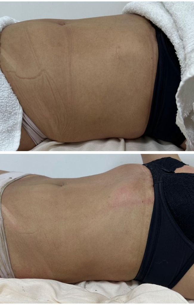 Antes e Depois Detox Slim